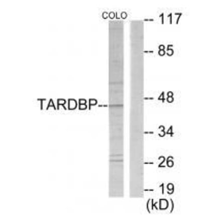 Western blot - TBX1 Antibody from Signalway Antibody (33584) - Antibodies.com