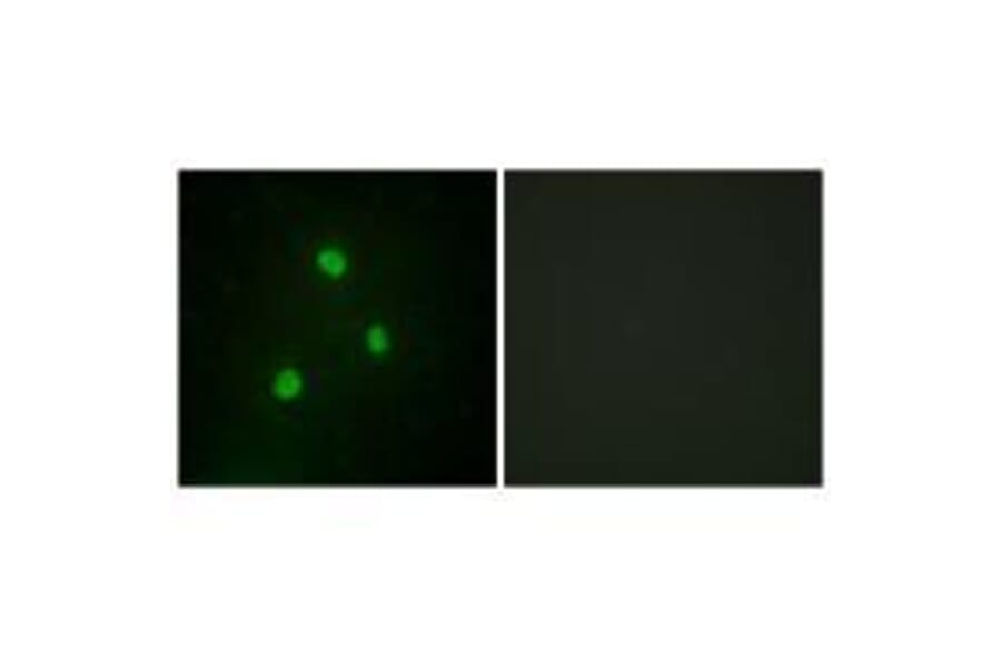 Immunofluorescence - TBX1 Antibody from Signalway Antibody (33584) - Antibodies.com