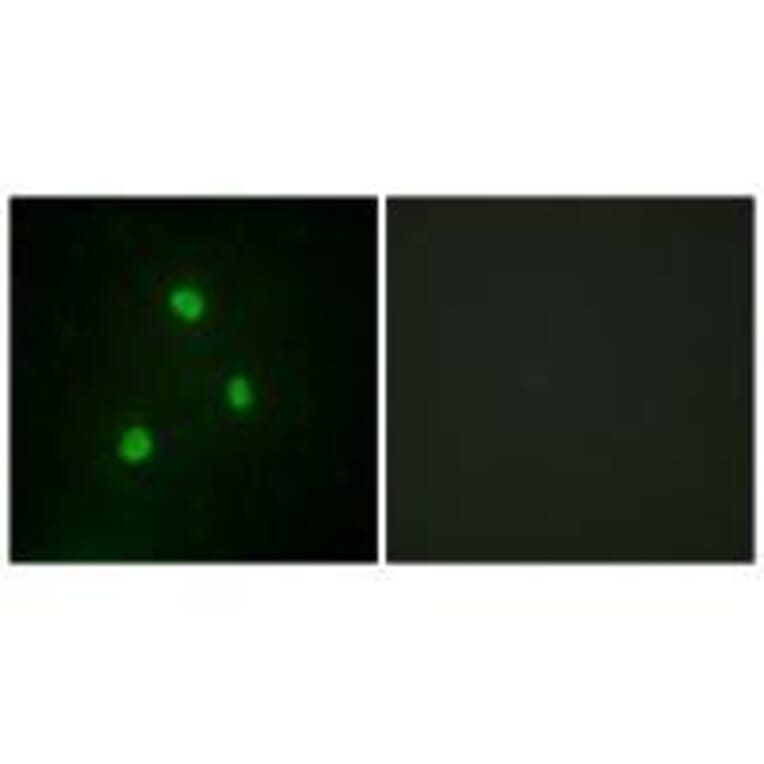 Immunofluorescence - TBX1 Antibody from Signalway Antibody (33584) - Antibodies.com