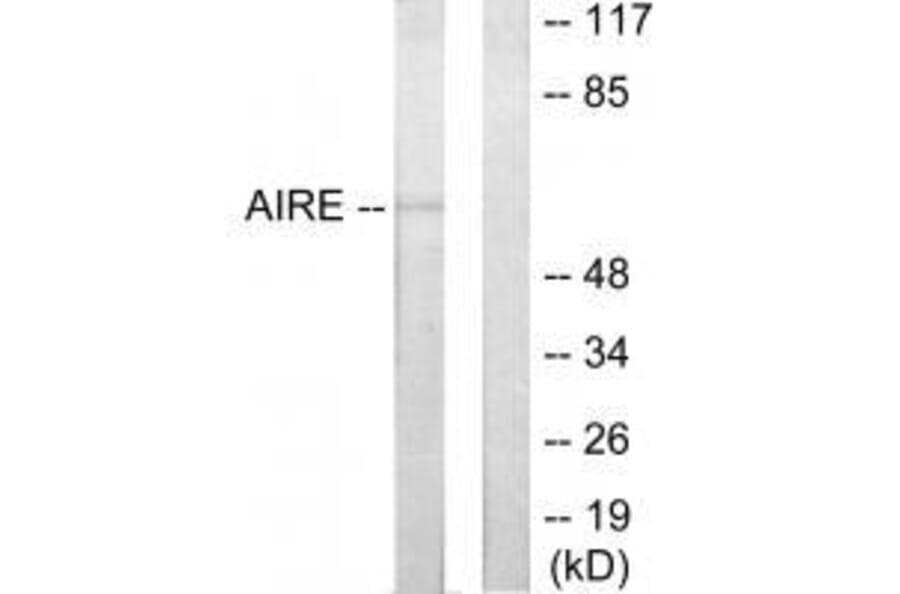 Western blot - AIRE Antibody from Signalway Antibody (33590) - Antibodies.com