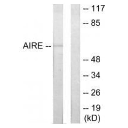 Western blot - AIRE Antibody from Signalway Antibody (33590) - Antibodies.com