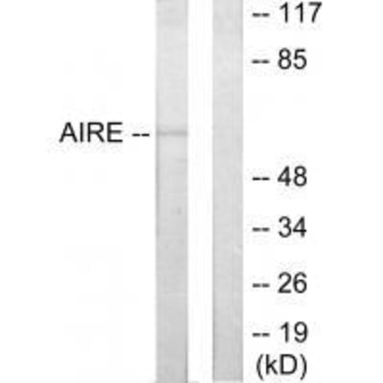 Western blot - AIRE Antibody from Signalway Antibody (33590) - Antibodies.com