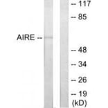 Western blot - AIRE Antibody from Signalway Antibody (33590) - Antibodies.com