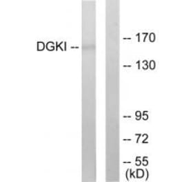 Western blot - DGKI Antibody from Signalway Antibody (33619) - Antibodies.com
