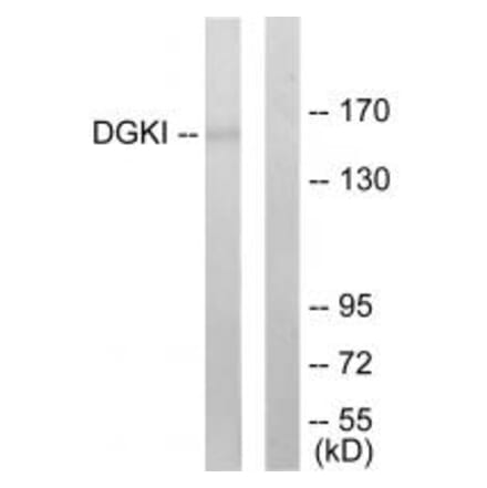Western blot - DGKI Antibody from Signalway Antibody (33619) - Antibodies.com