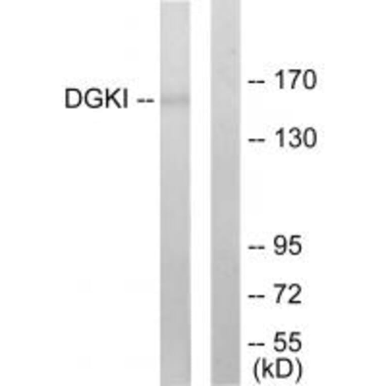 Western blot - DGKI Antibody from Signalway Antibody (33619) - Antibodies.com