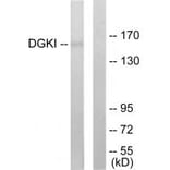 Western blot - DGKI Antibody from Signalway Antibody (33619) - Antibodies.com
