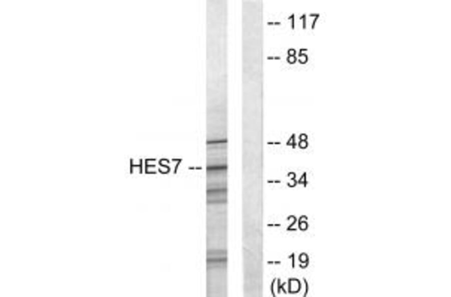 Western blot - HES7 Antibody from Signalway Antibody (33624) - Antibodies.com