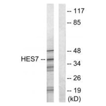 Western blot - HES7 Antibody from Signalway Antibody (33624) - Antibodies.com