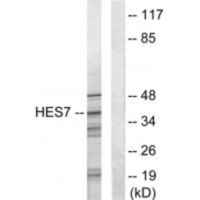 Western blot - HES7 Antibody from Signalway Antibody (33624) - Antibodies.com