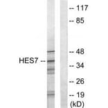 Western blot - HES7 Antibody from Signalway Antibody (33624) - Antibodies.com