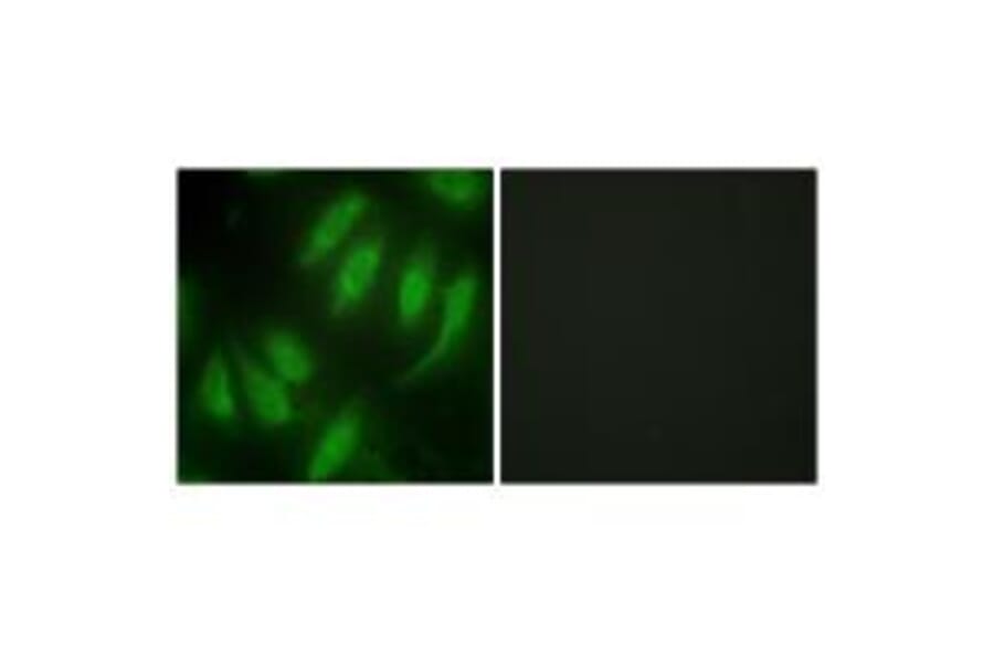 Immunofluorescence - HES7 Antibody from Signalway Antibody (33624) - Antibodies.com