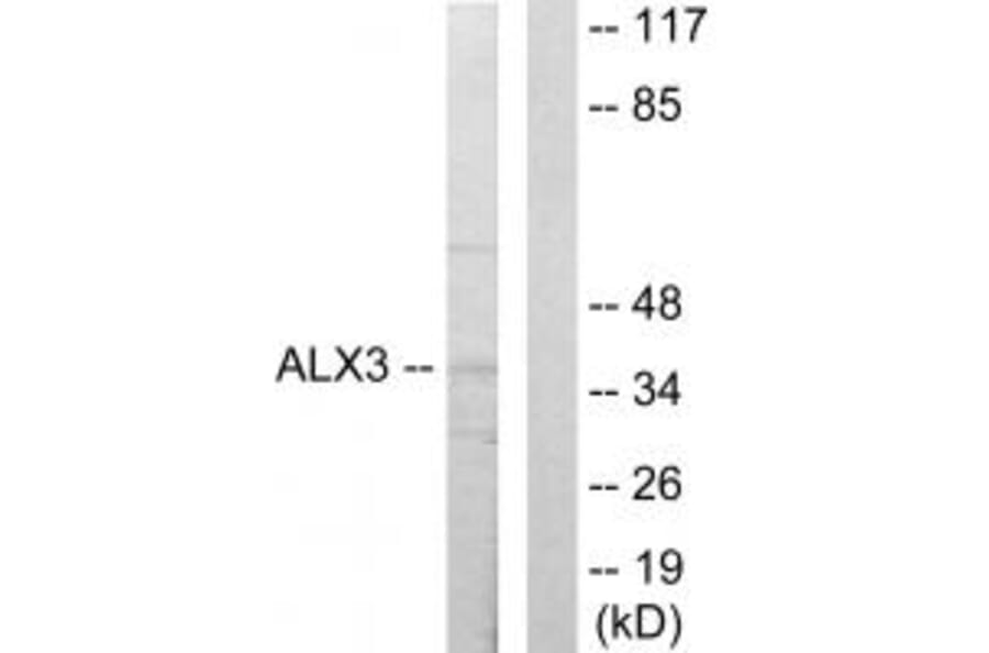 Western blot - ALX3 Antibody from Signalway Antibody (33625) - Antibodies.com