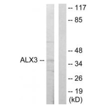 Western blot - ALX3 Antibody from Signalway Antibody (33625) - Antibodies.com