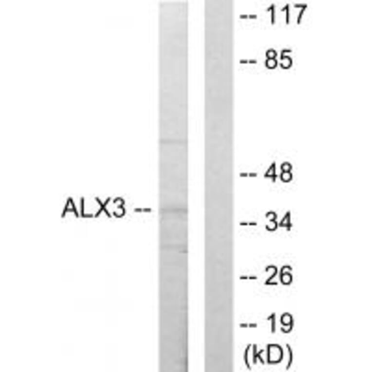 Western blot - ALX3 Antibody from Signalway Antibody (33625) - Antibodies.com