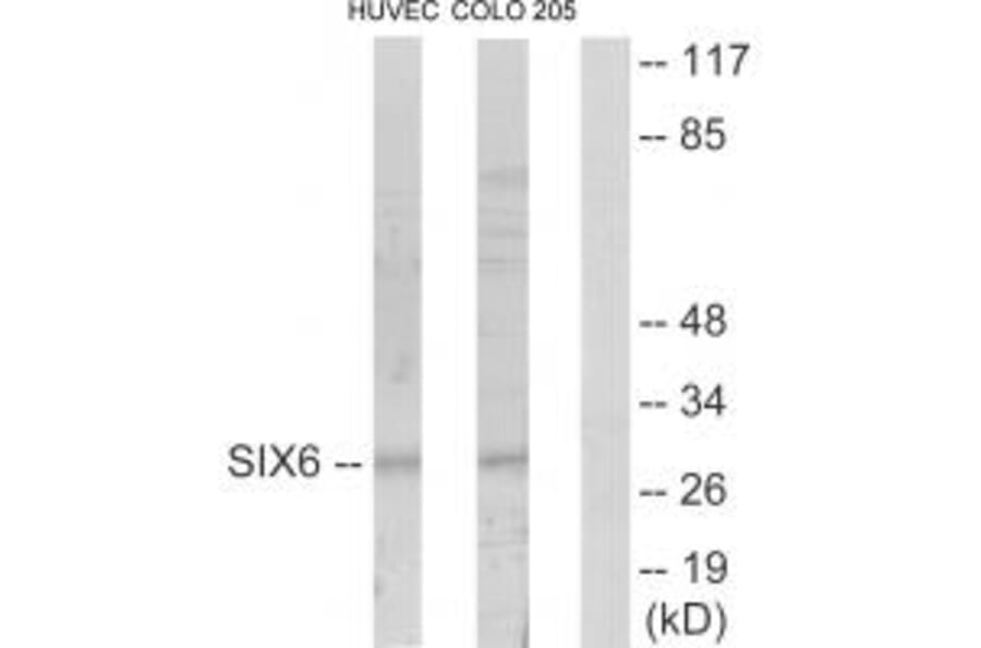 Western blot - SIX6 Antibody from Signalway Antibody (33634) - Antibodies.com