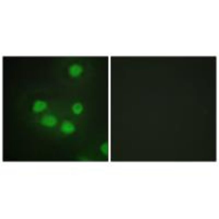 Immunofluorescence - SIX6 Antibody from Signalway Antibody (33634) - Antibodies.com