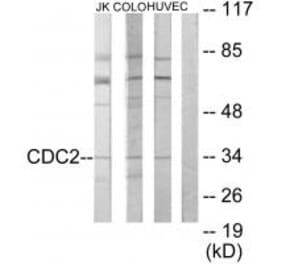 Western blot - CDC2 Antibody from Signalway Antibody (33653) - Antibodies.com