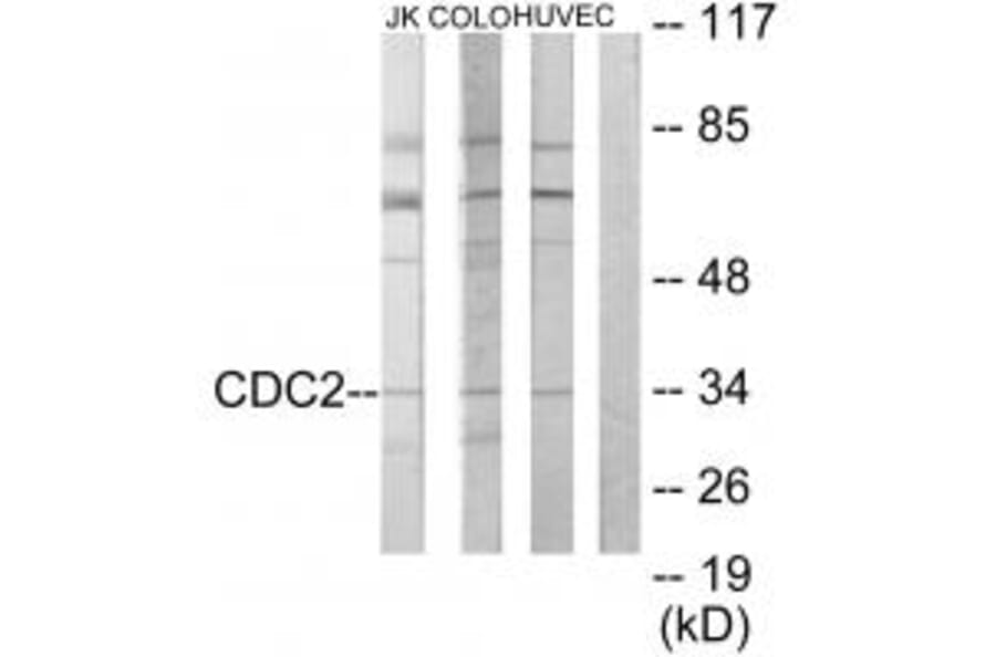 Western blot - CDC2 Antibody from Signalway Antibody (33653) - Antibodies.com