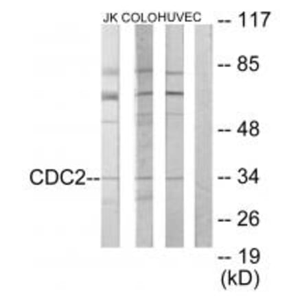 Western blot - CDC2 Antibody from Signalway Antibody (33653) - Antibodies.com