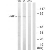 Western blot analysis of extracts from HeLa cells, Jurkat cells and COLO205 cells, using HKR1 antibody #33666.