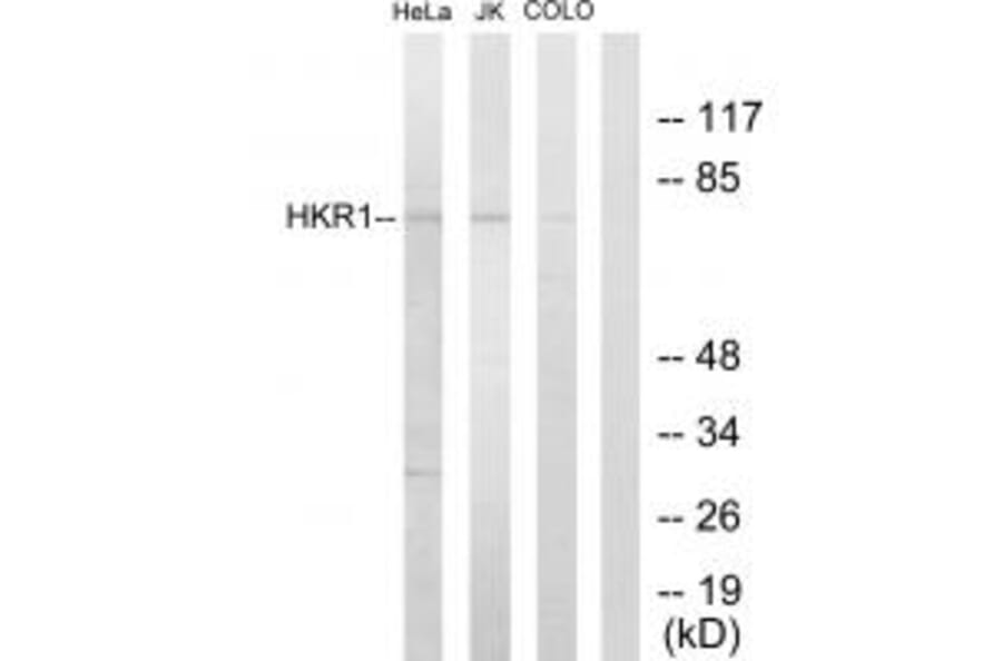 Western blot - HKR1 Antibody from Signalway Antibody (33666) - Antibodies.com
