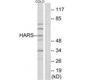Western blot - HARS Antibody from Signalway Antibody (33673) - Antibodies.com