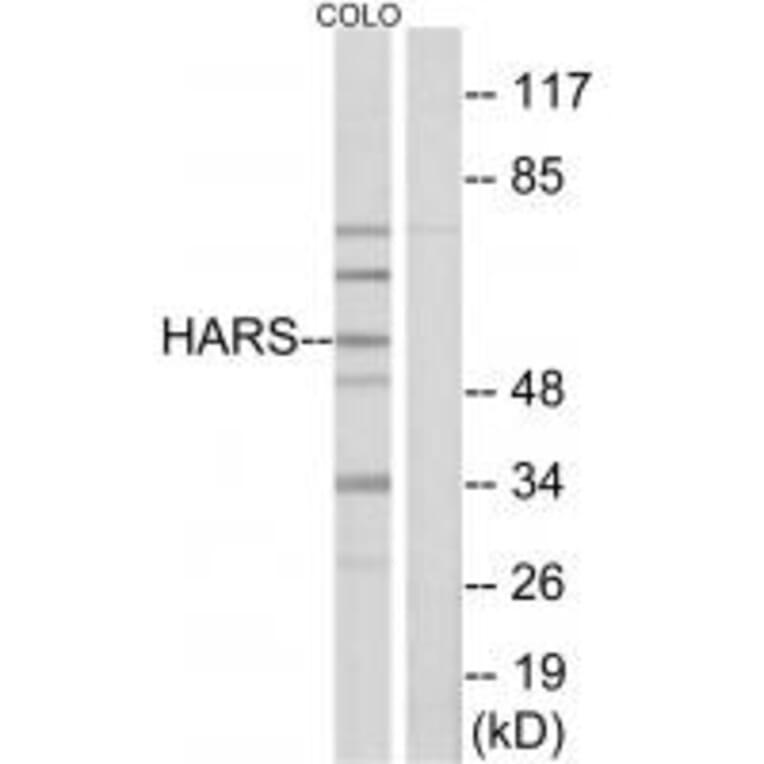 Western blot - HARS Antibody from Signalway Antibody (33673) - Antibodies.com