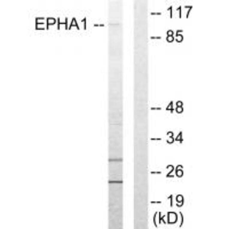 Western blot - EPHA1Antibody from Signalway Antibody (33716) - Antibodies.com