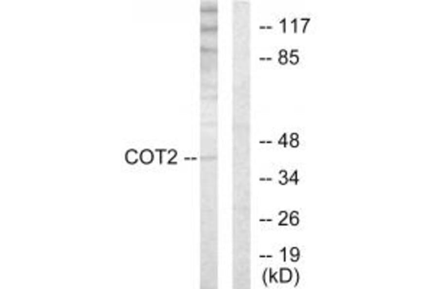 Western blot - COT2 Antibody from Signalway Antibody (33724) - Antibodies.com