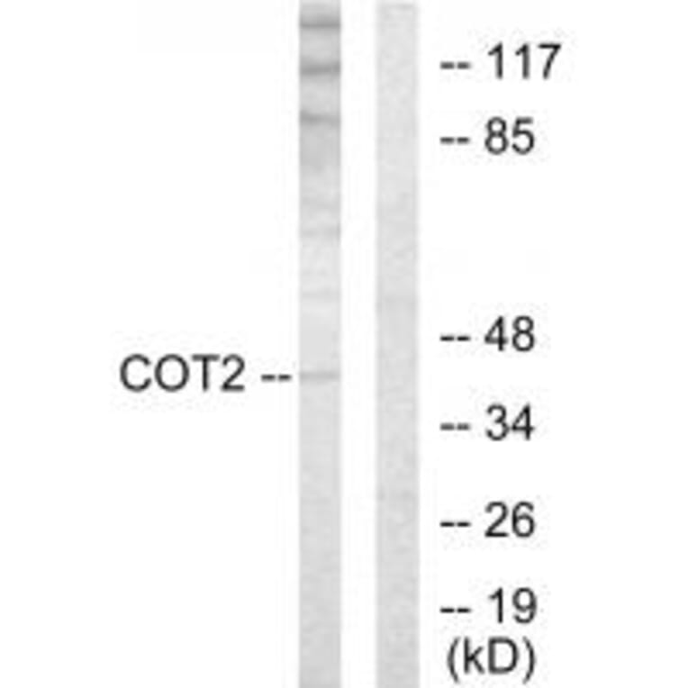 Western blot - COT2 Antibody from Signalway Antibody (33724) - Antibodies.com