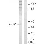 Western blot - COT2 Antibody from Signalway Antibody (33724) - Antibodies.com