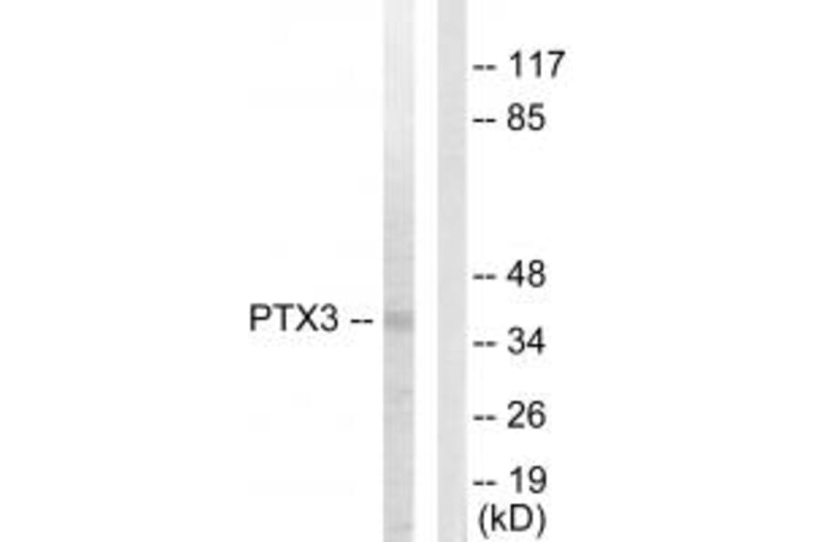 Western blot - PTX3 Antibody from Signalway Antibody (33727) - Antibodies.com