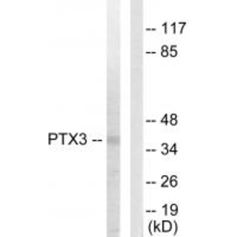 Western blot - PTX3 Antibody from Signalway Antibody (33727) - Antibodies.com