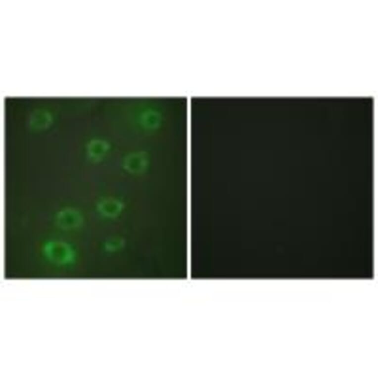 Immunofluorescence - PTX3 Antibody from Signalway Antibody (33727) - Antibodies.com