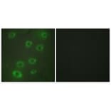 Immunofluorescence - PTX3 Antibody from Signalway Antibody (33727) - Antibodies.com