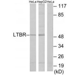 Western blot - LTBR Antibody from Signalway Antibody (33761) - Antibodies.com
