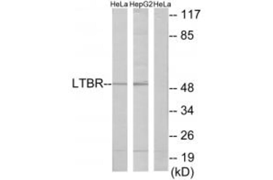 Western blot - LTBR Antibody from Signalway Antibody (33761) - Antibodies.com