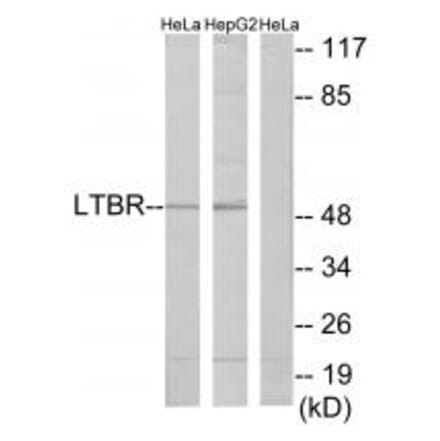 Western blot - LTBR Antibody from Signalway Antibody (33761) - Antibodies.com