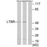 Western blot - LTBR Antibody from Signalway Antibody (33761) - Antibodies.com