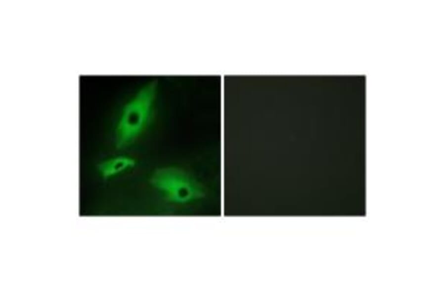 Immunofluorescence - LTBR Antibody from Signalway Antibody (33761) - Antibodies.com