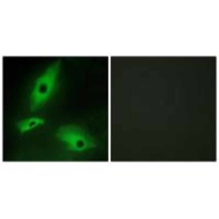 Immunofluorescence - LTBR Antibody from Signalway Antibody (33761) - Antibodies.com