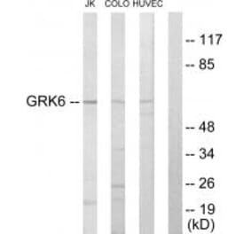 Western blot - GRK6 Antibody from Signalway Antibody (33771) - Antibodies.com