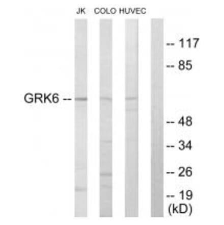 Western blot - GRK6 Antibody from Signalway Antibody (33771) - Antibodies.com