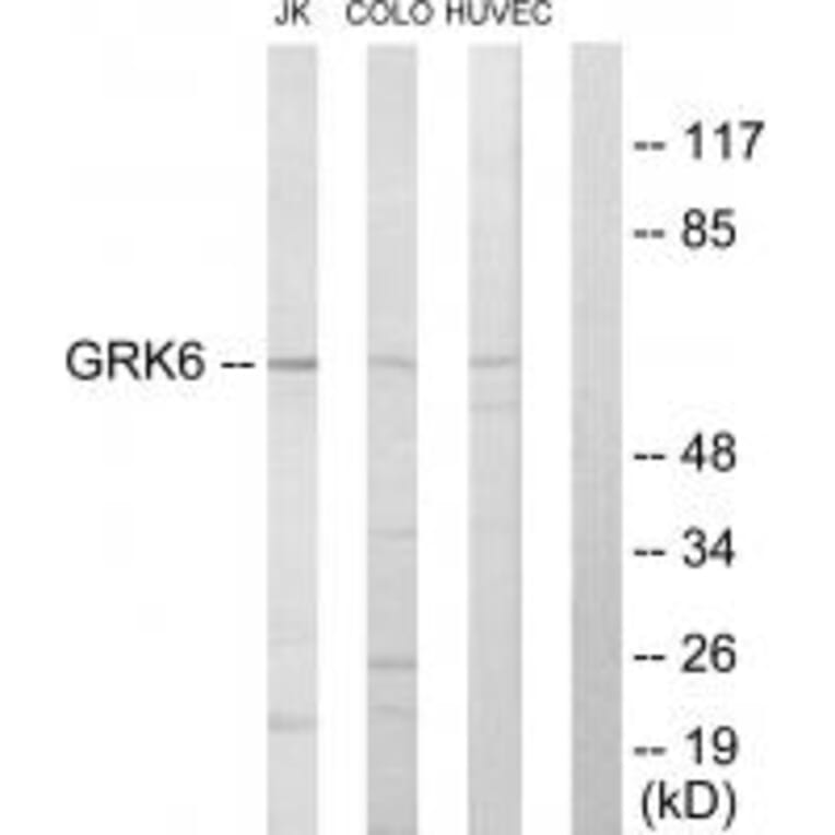 Western blot - GRK6 Antibody from Signalway Antibody (33771) - Antibodies.com