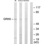 Western blot - GRK6 Antibody from Signalway Antibody (33771) - Antibodies.com