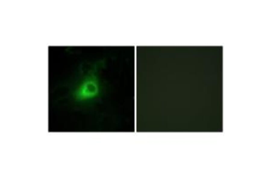 Immunofluorescence - GRK6 Antibody from Signalway Antibody (33771) - Antibodies.com