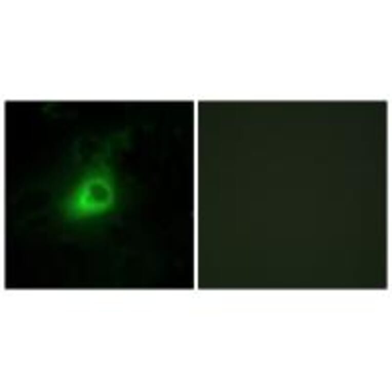 Immunofluorescence - GRK6 Antibody from Signalway Antibody (33771) - Antibodies.com