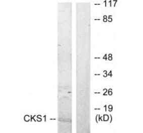 Western blot - CKS1 Antibody from Signalway Antibody (33830) - Antibodies.com