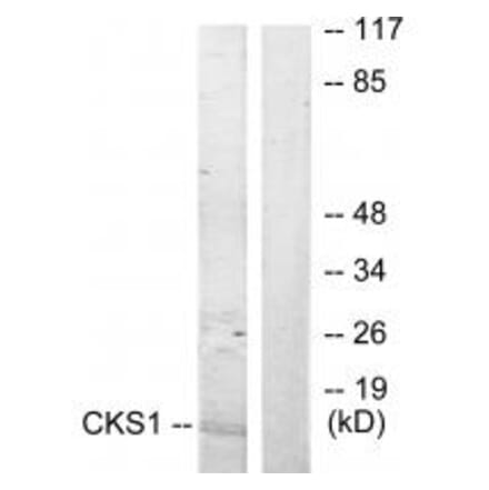 Western blot - CKS1 Antibody from Signalway Antibody (33830) - Antibodies.com